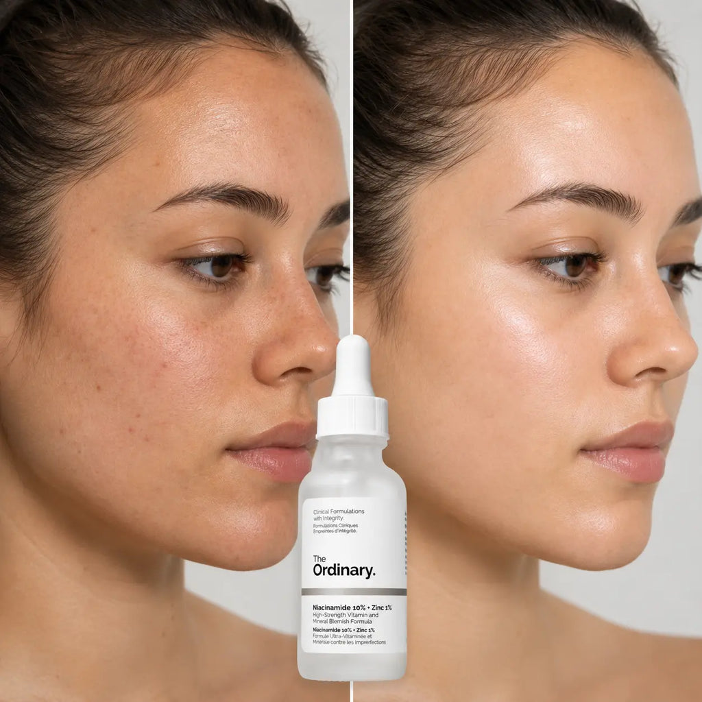 The Ordinary Niacinamide Serum